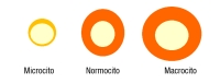 Representación de tres hematíes de distintos tamaños identificados cada uno con un rótulo (microcitos, normocitos y macrocitos). Tres círculos naranjas, cada uno de ello con una zona central más clara también.