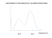 Representación gráfica en sistema de ejes, situándose en el eje de abscisas los distintos volúmenes de los hematíes y en ordenadas la frecuencia de aparición. La curva posee dos picos marcados con 65 fl y 85 fl. 