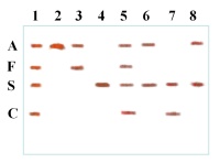 Esquema de una electroforesis de hemoglobina con ocho muestras donde se observan la aparición de bandas correspondientes a distintos tipos de hemoglobinas.