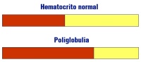 Imagen de dos capilares de hematocrito ya centrifugados donde se observa la diferencia entre una muestra de sangre normal y otra afectada por una poliglobulia.