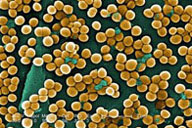 Imagen del microscopio de barrido donde se observan unas bacterias de forma esférica y color amarillo sobre un fondo verde.