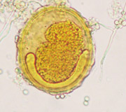 La imagen el aspecto de un huevo de helminto al microscopio teñido con lugol. En el interior del huevo se puede apreciar la larva del gusano.