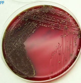 Es una imagen de una placa de agar sangre sembrada por la técnica de estría múltiple. Se observan colonias aisladas en los últimos pasos del procedimiento.