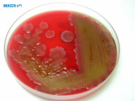 Cultivo de una bacteria sobre una placa de agar.