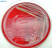 Cultivo de una bacteria sobre la placa de agar.