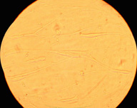 La imagen muestra el aspecto que presentan las células creciendo en monocapa cuando se las observa utilizando un microscopio invertido.