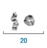 La imagen corresponde a una fotografía de un anillo cromosómico observado en una metafase con bandas G. El cromosoma implicado es el número 20.