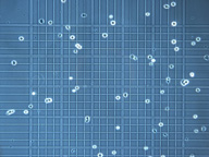 La imagen muestra células brillantes y de forma redondeada sobre el retículo de una cámara de recuento tal y como se observan cuando se enfoca la cámara en el microscopio.
