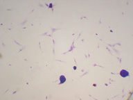 En la imagen se observa el aspecto que presentan las células de un cultivo teñido con Giemsa. Entre las células se observa la presencia de unas estructuras redondeadas teñidas intensamente por el colorante que podrían corresponder a hongos.