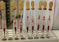 En la imagen se observa una gradilla que sujeta varios tubos de vidrio con pipetas Pasteur en su interior. En el extremo superior de cada pipeta hay un auxiliar de pipeteado y en el interior de cada una de ellas se puede apreciar la muestra de sangre periférica que esta siendo preparada para el análisis.