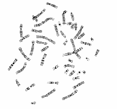 La imagen corresponde a una fotografía tomada  en el microscopio en la que se ve el aspecto que muestran los cromosomas tras la realización de la técnica de bandeado G.