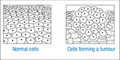 En la imagen se puede apreciar un dibujo que simula un tejido normal y a su derecha otro dibujo del mismo tejido en el que se ha producido la proliferación de algunas de sus células dando lugar a un tumor.