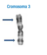 En la imagen se puede observar el patrón de bandas característico de este cromosoma. A la izquierda se han señalado con flechas las bandas que permiten su identificación inicial 3.