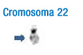 Cromosoma 22. En la imagen se puede observar el patrón de bandas característico de este cromosoma. A la izquierda se han señalado con flechas la banda que permite su identificación inicial 22.