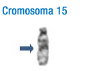 En la imagen se puede observar el patrón de bandas característico de este cromosoma. A la izquierda se han señalado con flechas las bandas que permiten su identificación inicial 15.