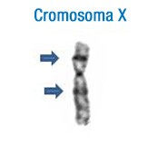 En la imagen se puede observar el patrón de bandas de este cromosoma. A la izquierda se han señalado con flechas las bandas más características que permiten su identificación inicial X.