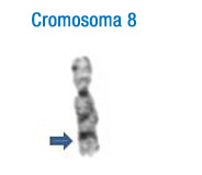 En la imagen se puede observar el patrón de bandas de este cromosoma. A la izquierda se han señalado con flechas las bandas más características que permiten su identificación inicial 8.