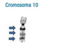 En la imagen se puede observar el patrón de bandas de este cromosoma. A la izquierda se han señalado con flechas las bandas más características que permiten su identificación inicial 10.