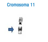 En la imagen se puede observar el patrón de bandas de este cromosoma. A la izquierda se han señalado con flechas las bandas más características que permiten su identificación.