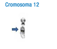 En la imagen se puede observar el patrón de bandas de este cromosoma. A la izquierda se han señalado con flechas las bandas más características que permiten su identificación inicial 12.