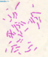 En la imagen se observa una metafase, teñida con tinción sólida, vista al microscopio con el objetivo de 100 aumentos.