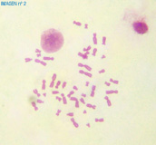 En la imagen se observa una metafase, teñida con tinción sólida, vista al microscopio con el objetivo de 100 aumentos.