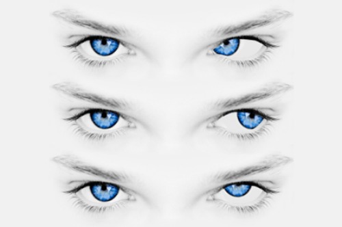 Nistagmus